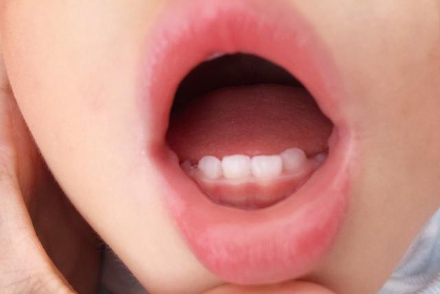 为何有些孩子出牙早有些孩子出牙晚有几个细节需要家长注意