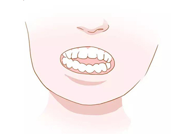 人类幼崽迷惑行为之咬手指的危害