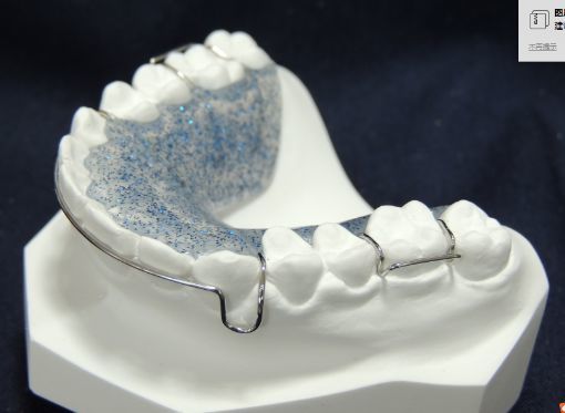 牙齿矫正后如何避免反弹齿科医生戴好保持器是关键