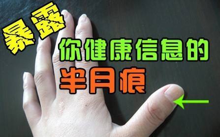 指甲上的月牙印代表什么呢?
