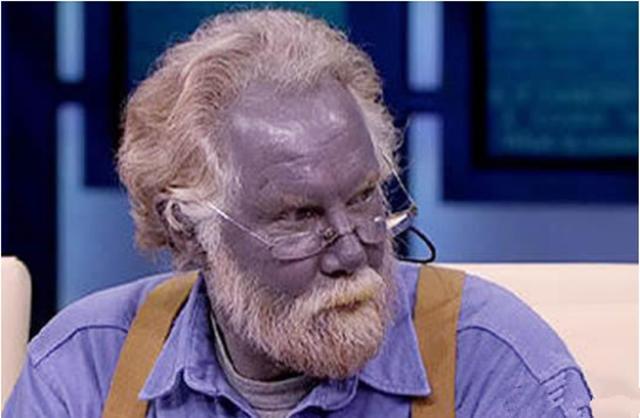 世界上最奇怪的六大种族最后一个是蓝种人血也是蓝色的