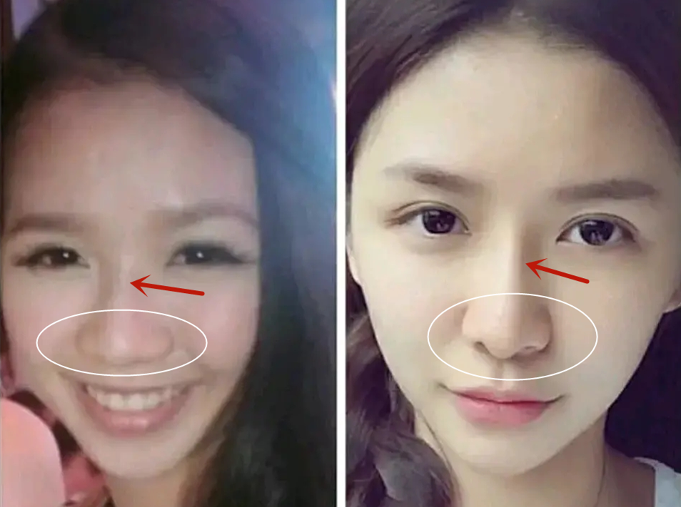 假离婚的蔡卓宜,与baby同款龅牙,整容换脸捧成仙女?_腾讯新闻