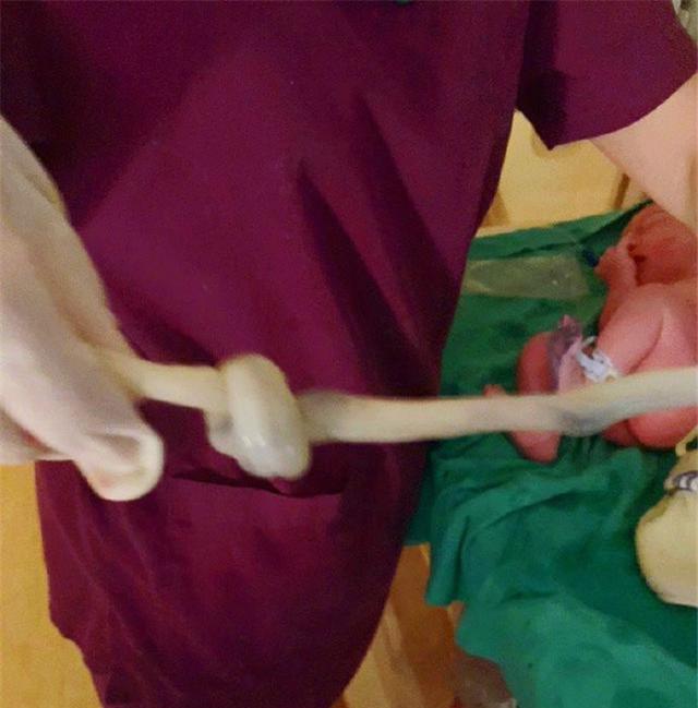 谢依霖水中分娩生二胎晒脐带打结照网友平安有了还差喜乐