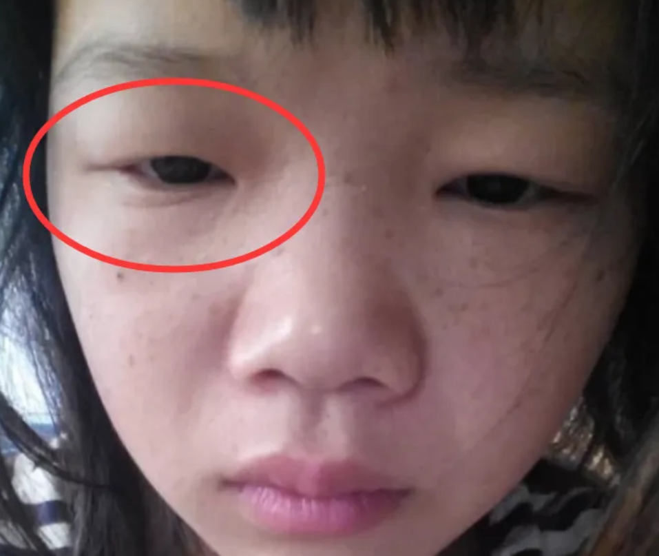 单眼皮不算丑,有这3种眼型的女生,颜值才叫人"一言难尽"
