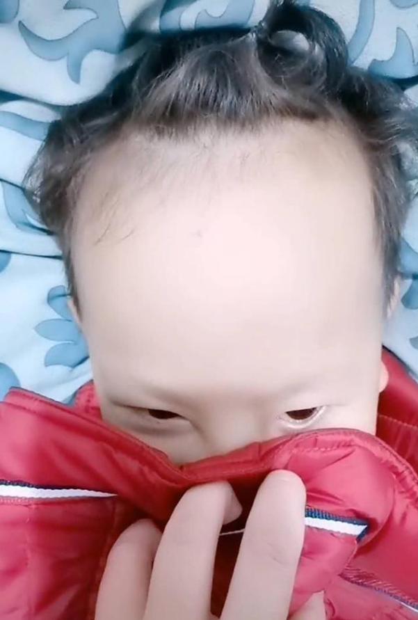 宝妈吐槽儿子"脑门大",额头占了一半脸,网友:还以为是后脑勺
