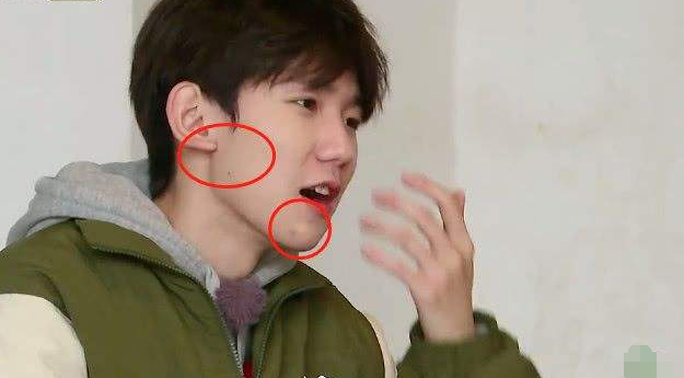 王源为何被嘲烂脸镜头拉近时一言难尽你才20岁啊