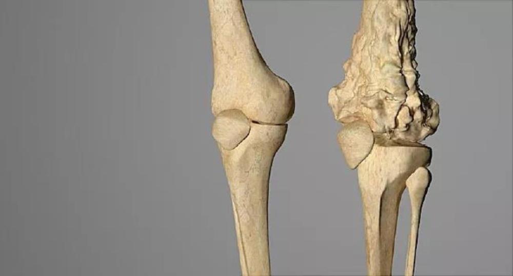 癌症的历史有多久远科学家在恐龙化石上找到癌变的骨头