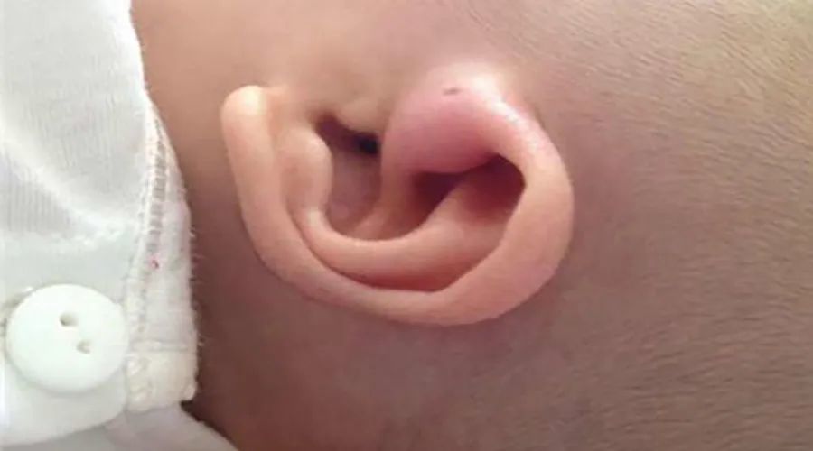 冷知识|身上最硬的地方是哪里？30 个身体冷知识