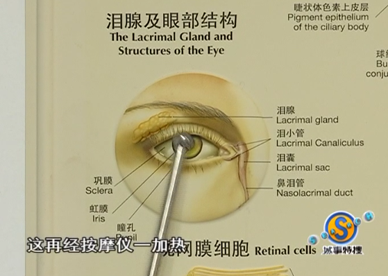 出事了广州女子一觉醒来竟成兔子眼