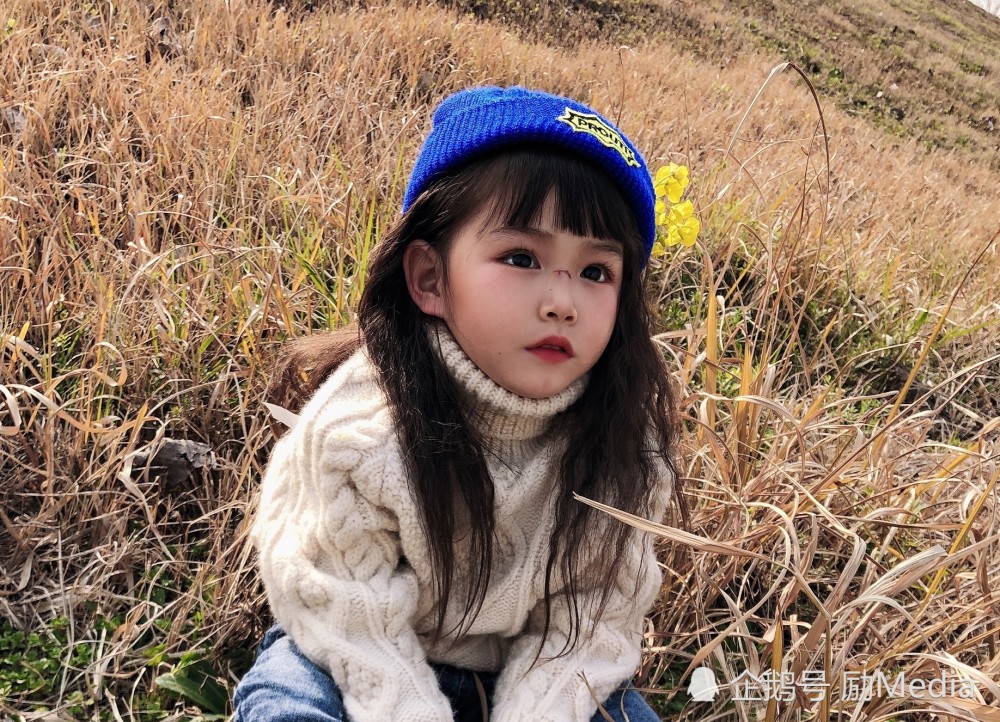 妮妮磕破了鼻梁