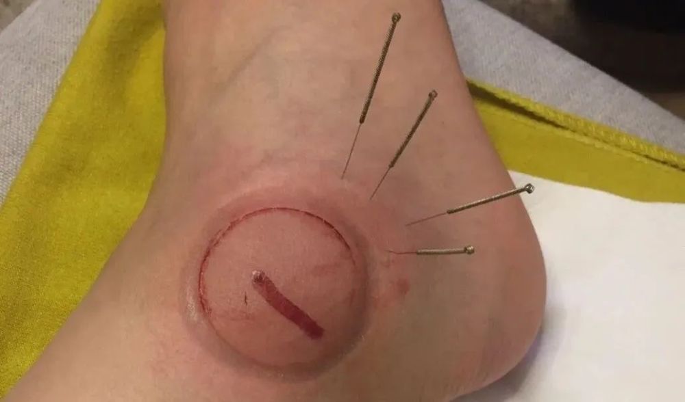 开始了全新的尝试娇嫩的正面皮肤统统开发就连肚脐眼也不放过痛感翻倍