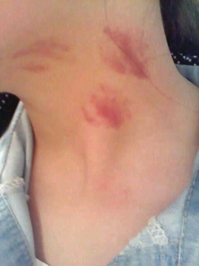 女生回家脖子有"草莓印",父母的追问下,孩子的回答太真实了_腾讯新闻