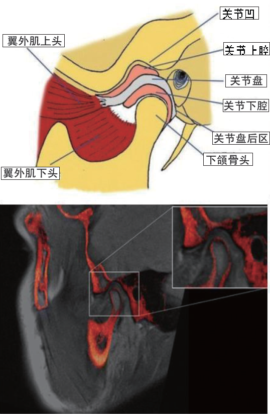 由下颌骨髁状突与颞骨下颌窝和关节结节组成,中央有关节盘,左右各一