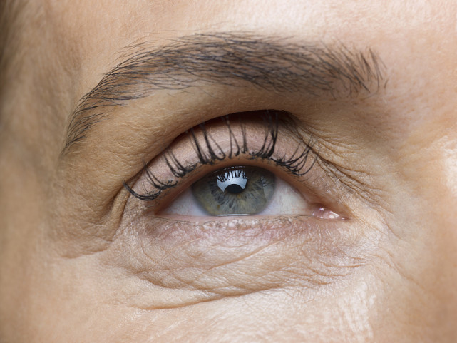 男人面相不同形状的鱼尾纹运势都有哪些不同 腾讯网