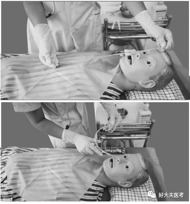 测量胃管插入长度,成人插入长度为45 ～ 55cm,测量方法有以下两种:一