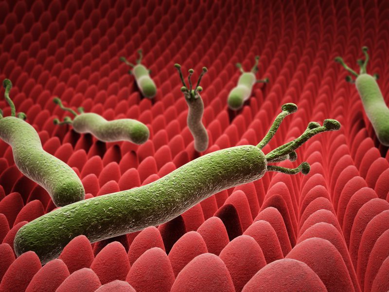 幽门螺旋杆菌|身体若出现4个异常，或是在提醒你：被幽门螺旋杆菌“缠上”了