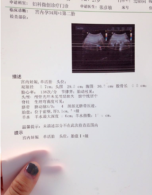 crl:头臀距头臀距表示的是胎体纵轴平衡测量的最大长轴,主要是用来
