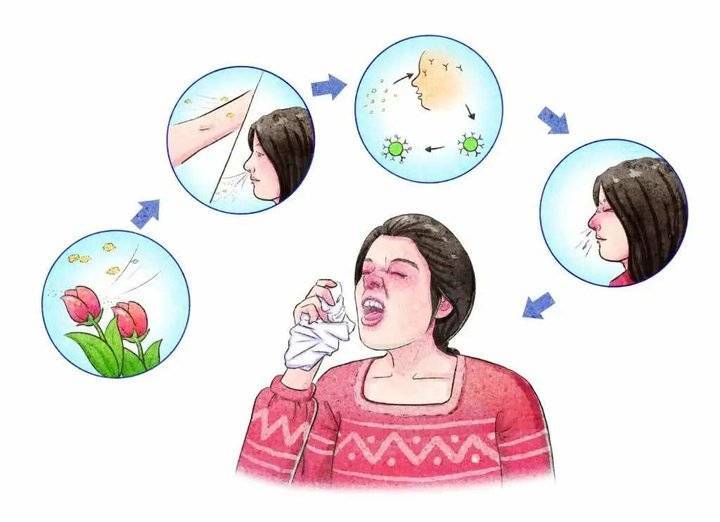 花粉季鼻炎又反复 听听专家怎么说 还有壹粉硬核支招 腾讯新闻