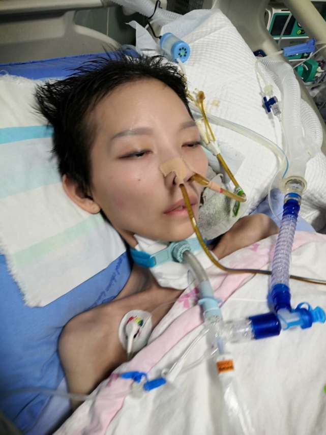 24岁美女因重度营养不良进icu,如今瘦到只有50斤