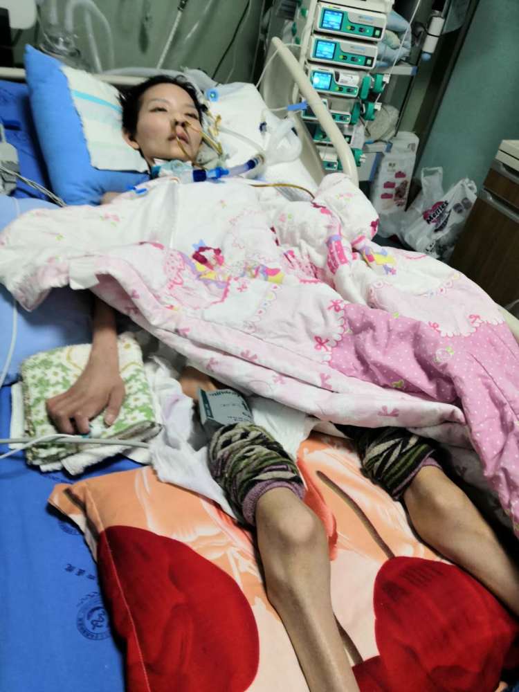 24岁美女因重度营养不良进icu如今瘦到只有50斤