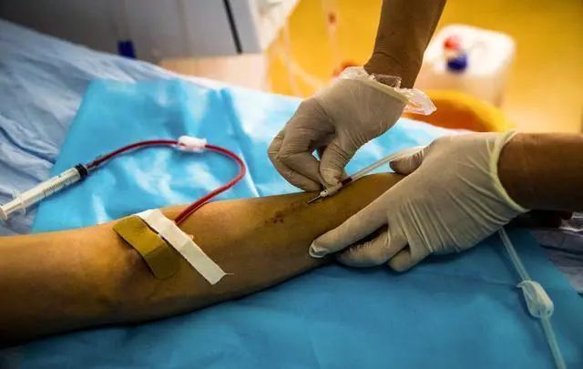 很多年轻人直到查出尿毒症,都不知道自己早就慢性肾衰了.