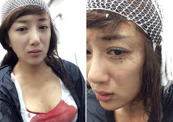 她被称为古装第一美人却被狗咬毁容整容多次也回不去了