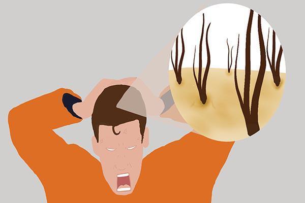 头发总是很油腻和什么有关如何获得干爽头发希望你能照着做