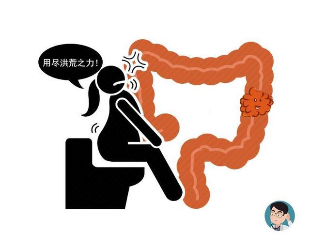 查德维克·博斯曼|黑豹演员因结肠癌去世：这4类人必须定期做肠镜，真不是图你钱！