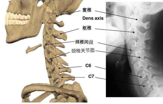 寰枢关节在哪个位置图片