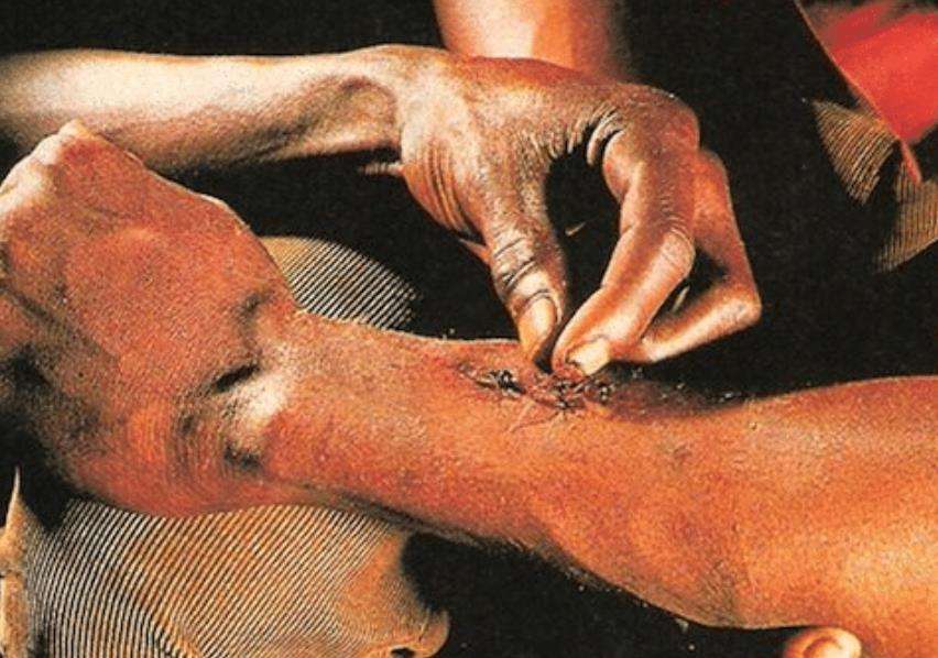 非洲流传已久的神奇巫术,治疗伤口只需蚂蚁缝合,专家:不可思议