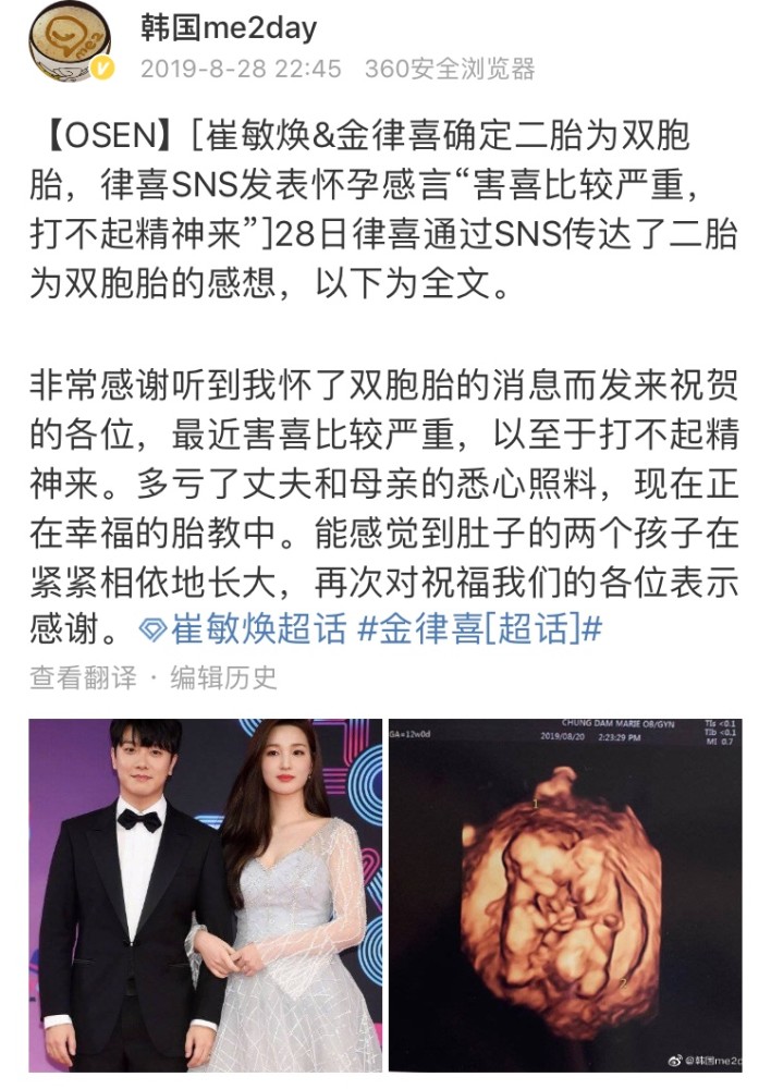 2019年8月,律喜公布了怀上双胞胎的消息,赞儿要有妹妹们啦!