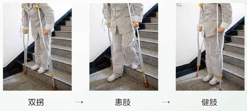 5,下楼梯法(1)先下拐杖,患肢跟上(2