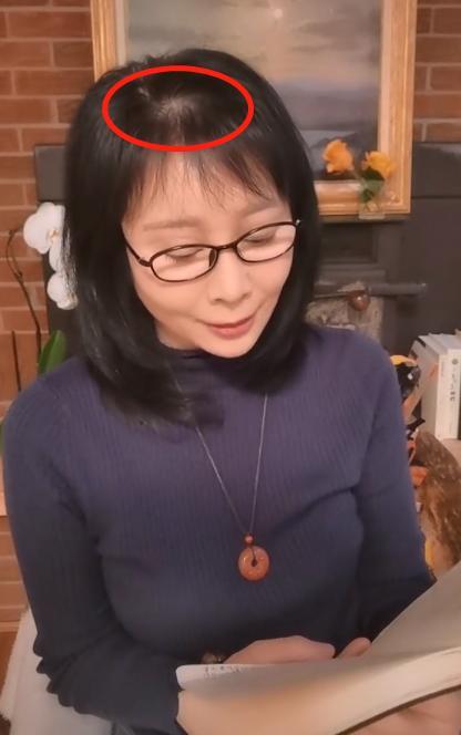 但岁月不饶人,在郑铮低头看书时,头顶头发略显稀疏,乌黑的头发中也藏