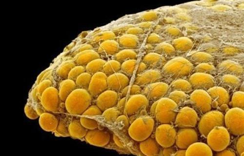 人体脂肪是怎样形成的?健身教练仔细讲给你