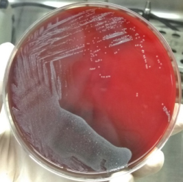 2019年9月10日,由于本菌在血平板上生长缓慢,菌种生长不良,此时鉴定会
