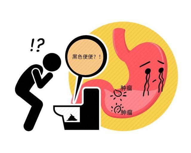 李建群|古装第一美人李建群因癌离世：早期4个症状，大部分患者都忽视