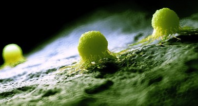 2,饮食不当:比如爱吃高脂肪,高蛋白食物,这些食物会增高胆汁中的