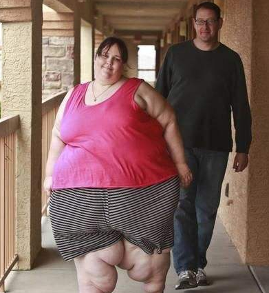 世界上最胖女人体重达到了1450斤21岁的小男友却为她痴狂
