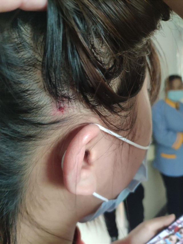 广州一男子殴打两名女护士被刑拘伤者面部头部损伤流血 腾讯网