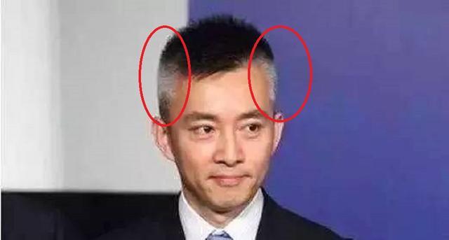 白发从哪里长,病从哪里来,长在两鬓,前额,头顶分别暗示什么?