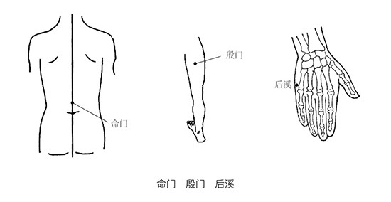 埋線療法治百病——腰肌勞損|腰肌勞損|督脈