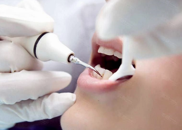 "黄牙"想变白就去洗?别天真了,洗牙和牙齿美白并不是一回事