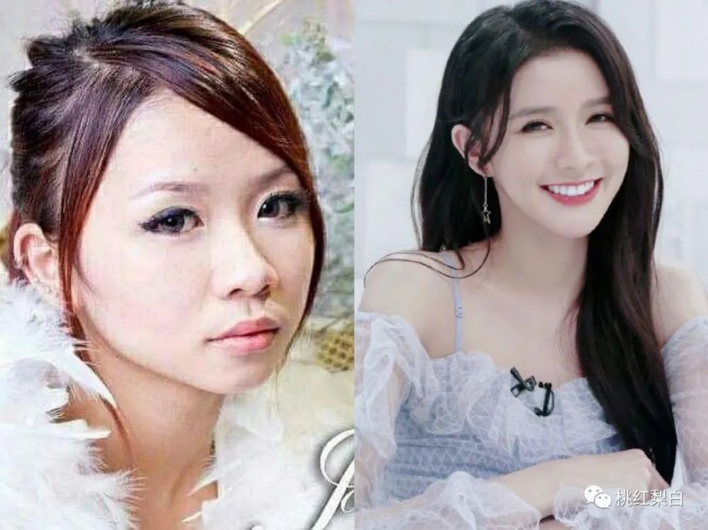 娄艺潇才32岁,脸就已经垮成"老太太"了?