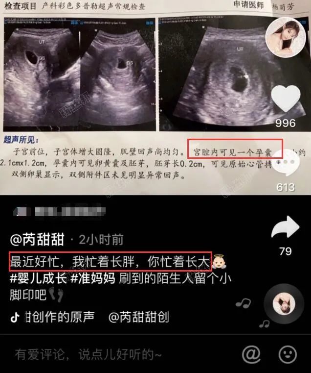 Yy芮甜甜宣布怀孕 忙着长胖做准妈妈 神豪哦哥突然上线豪刷13万 腾讯新闻