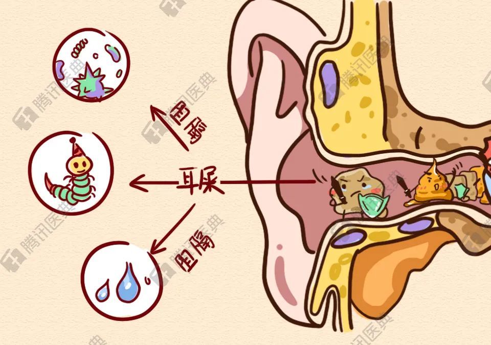 耳屎的成分 腾讯网