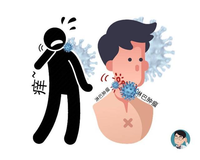 癌症|每天有1万多人被确诊为癌症？提醒：50岁后的男性，警惕这4个异样