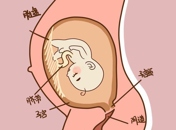 胎膜应该什么时候破为什么有时候医生要人工破膜