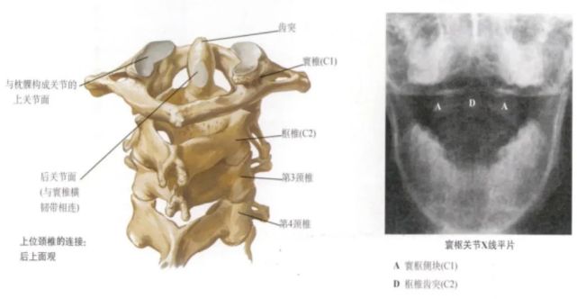 寰枢关节稳固性的结构:关节囊,寰枢前膜,寰枢后膜,覆膜,寰椎十字韧带