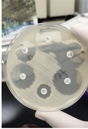 做好这 6 步,搞定儿科细菌感染