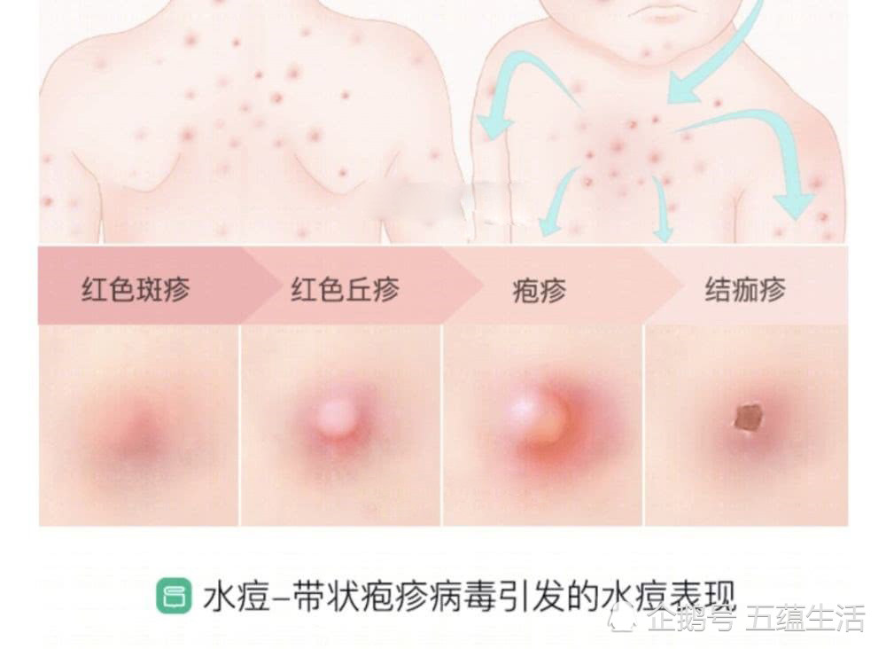 究竟是什么在作祟?
